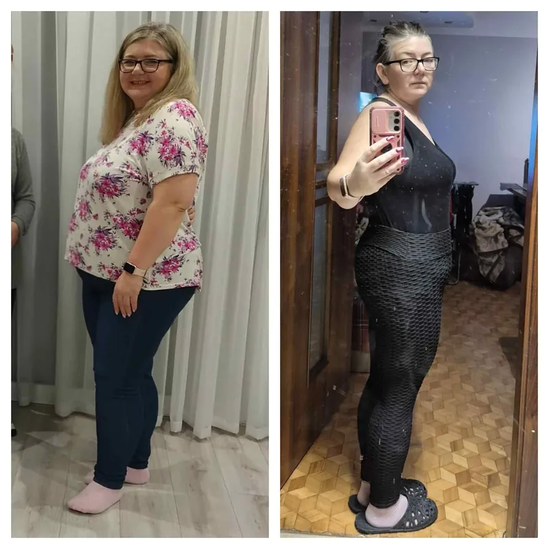 Pani Agnieszka przed i po redukcji 50 kg